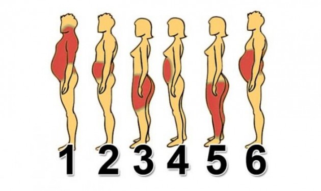Válassz az ábrák közül, hogy melyik testrészed hajlamos a hízásra! Tudd meg, hogy mi az oka a plusz kilóidnak!